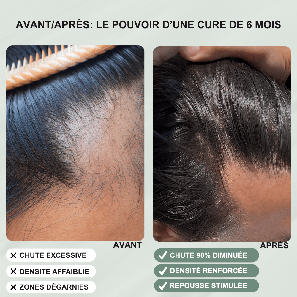 Shampoing élixir anti - chute - Yunae Beauty