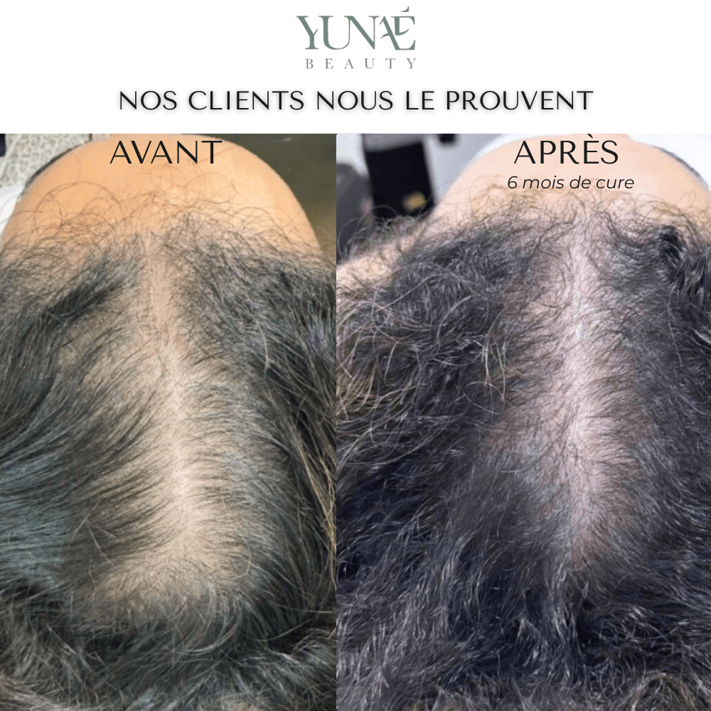 Shampoing Solide Anti - Chute — Élixir Concentré - Yunae Beauty