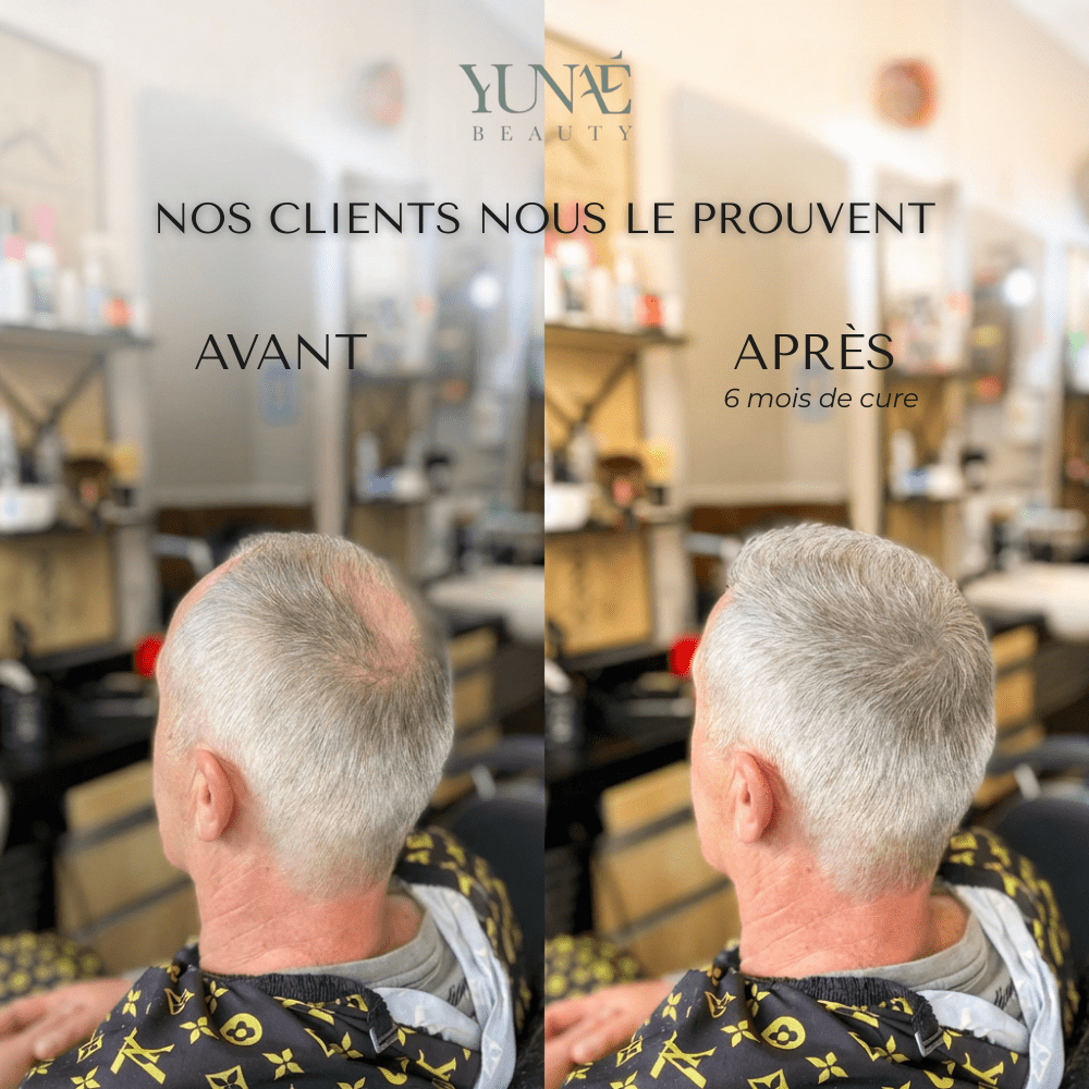 Shampoing Solide Anti - Chute — Élixir Concentré - Yunae Beauty