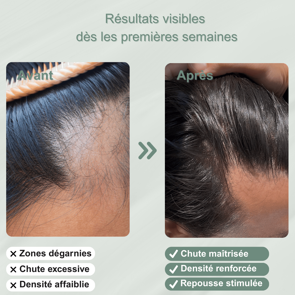 Shampoing solide anti - chute — stimule la repousse et renforce la racine - Yunae Beauty