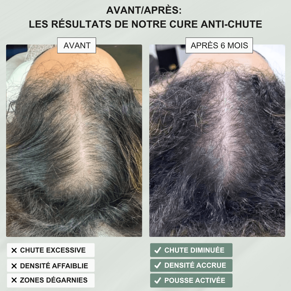Shampoing Élixir Anti - Chute - Yunae Beauty