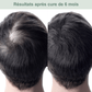 Shampoing solide anti - chute — stimule la repousse et renforce la racine - Yunae Beauty