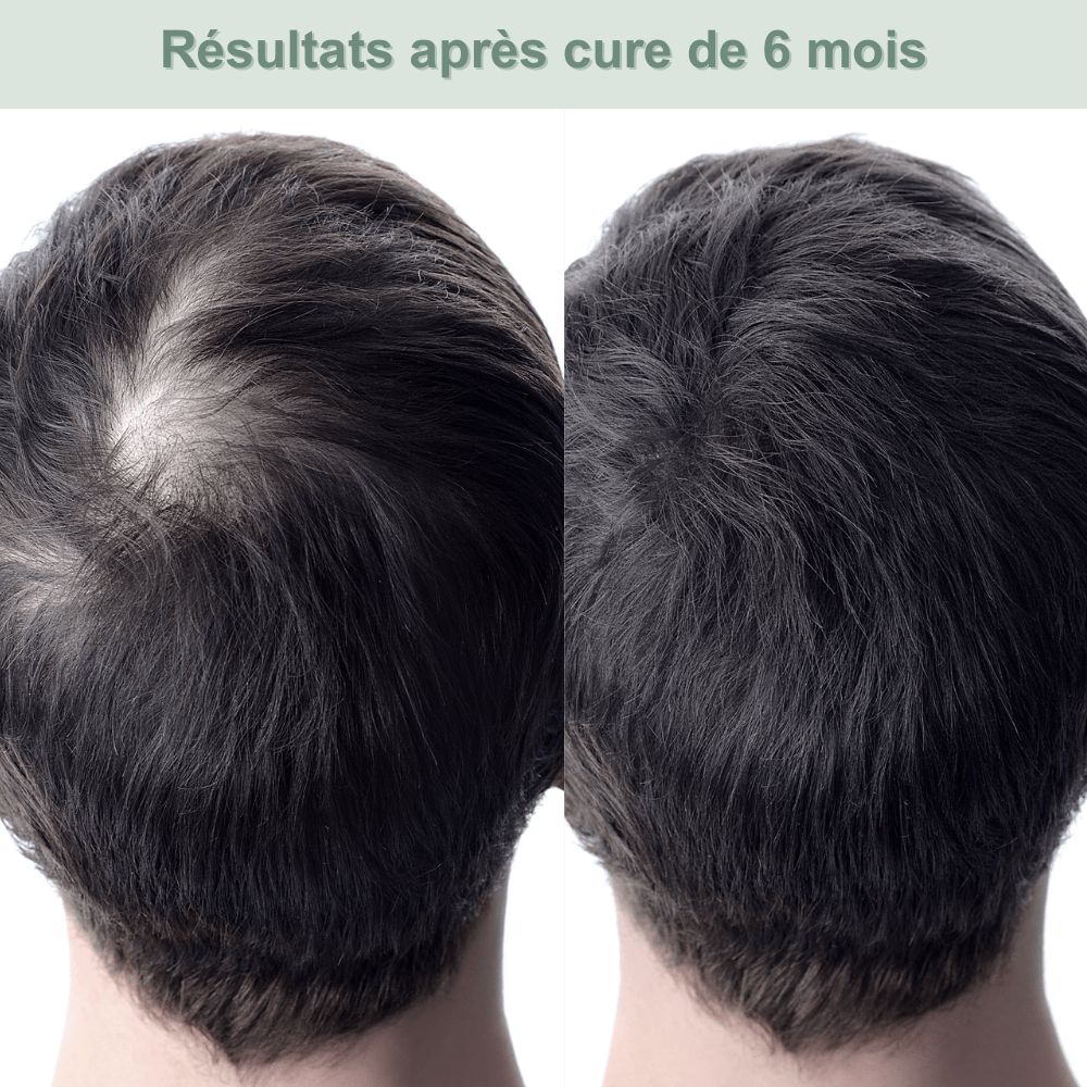 Shampoing solide anti - chute — stimule la repousse et renforce la racine - Yunae Beauty